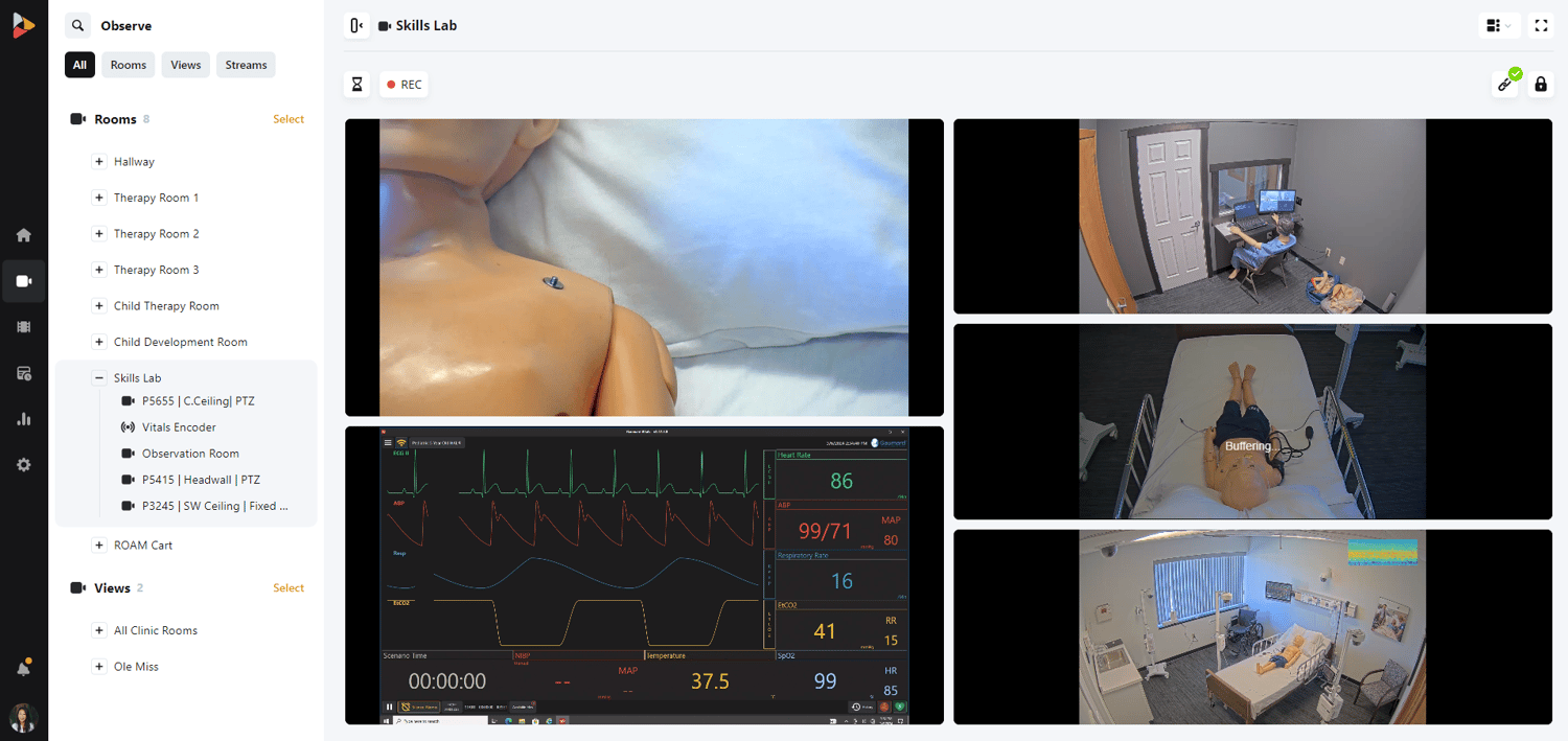 Simulation observe screen